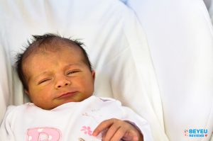 Trẻ sơ sinh bị vàng da khi nào cần được thăm khám điều trị.