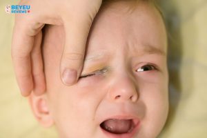 Hướng dẫn chăm sóc trẻ bị đau mắt đỏ tại nhà