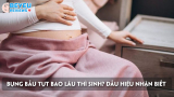 Bụng bầu tụt bao lâu thì sinh? Dấu hiệu nhận biết