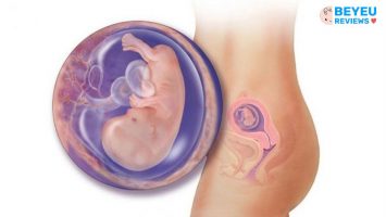 Chỉ số đường kính lưỡng đỉnh theo tuổi thai mẹ nên biết
