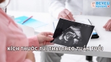 Kích thước túi thai theo tuần tuổi mà các bậc phụ huynh cần biết
