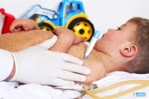 Cách phòng chống bệnh sởi hiệu quả cho các bé