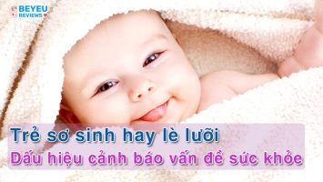Trẻ sơ sinh hay lè lưỡi: dấu hiệu cảnh báo vấn đề sức khỏe cần lưu tâm